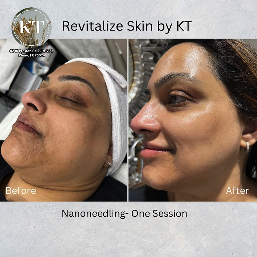 Benefits of Facials and Skin Treatments at REVITALIZE SKIN BY KT - Best day spa Plano, TX 75024